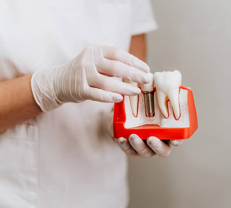 medic-stomatolog-bucuresti-implant-dentar